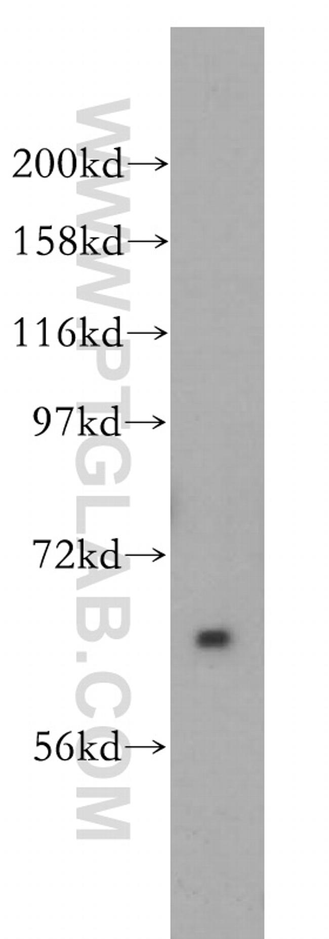 Pikachurin Antibody in Western Blot (WB)