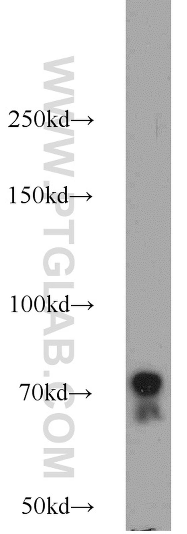 Perforin Antibody in Western Blot (WB)