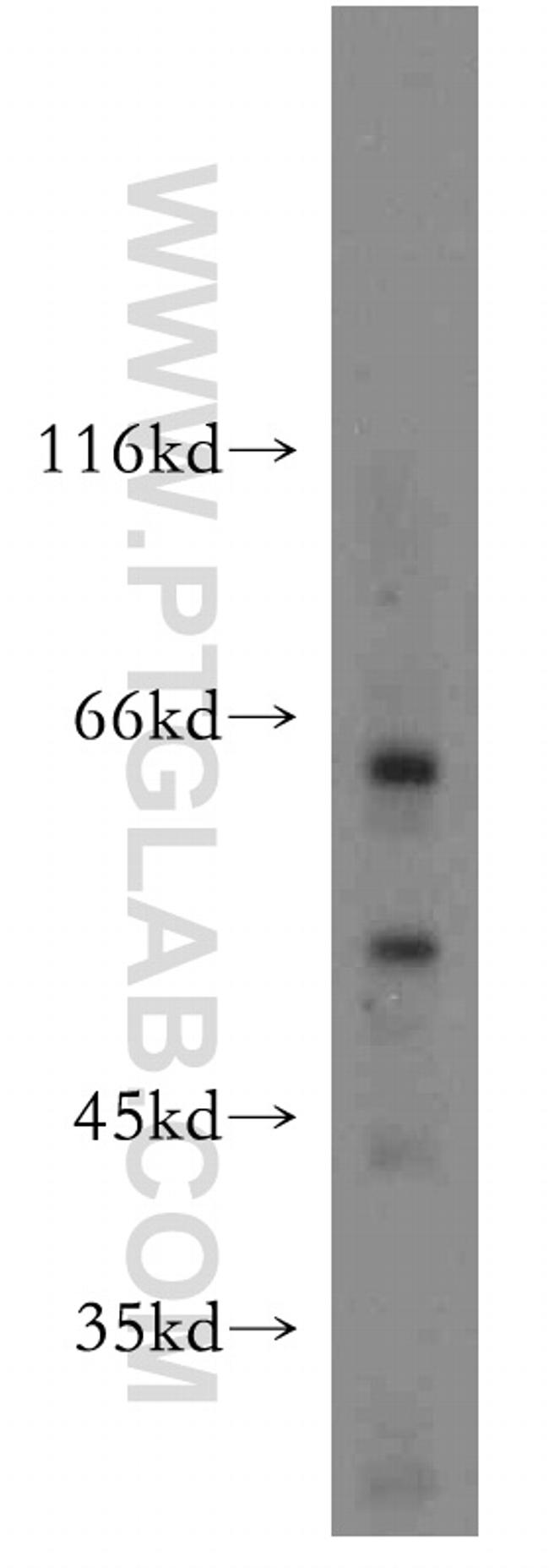 Perforin Antibody in Western Blot (WB)