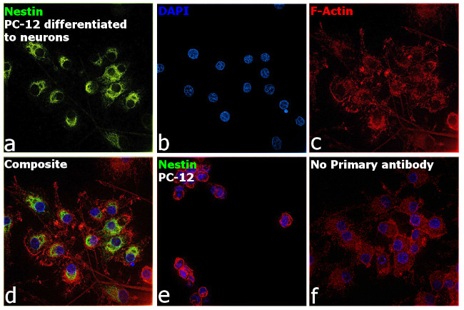 Nestin Antibody in Immunocytochemistry (ICC/IF)