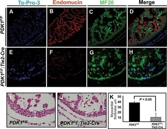 Endomucin Antibody in Immunohistochemistry (IHC)