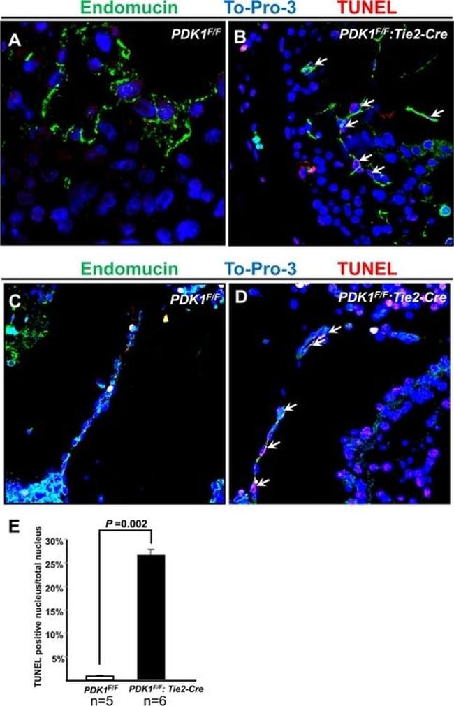 Endomucin Antibody in Immunohistochemistry (IHC)