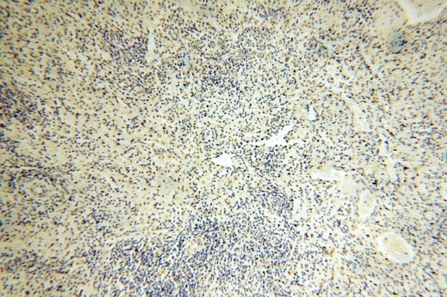 ERCC1 Antibody in Immunohistochemistry (Paraffin) (IHC (P))