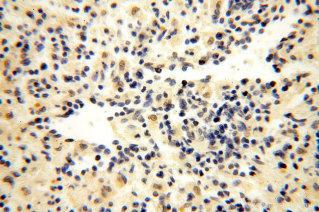 ERCC1 Antibody in Immunohistochemistry (Paraffin) (IHC (P))