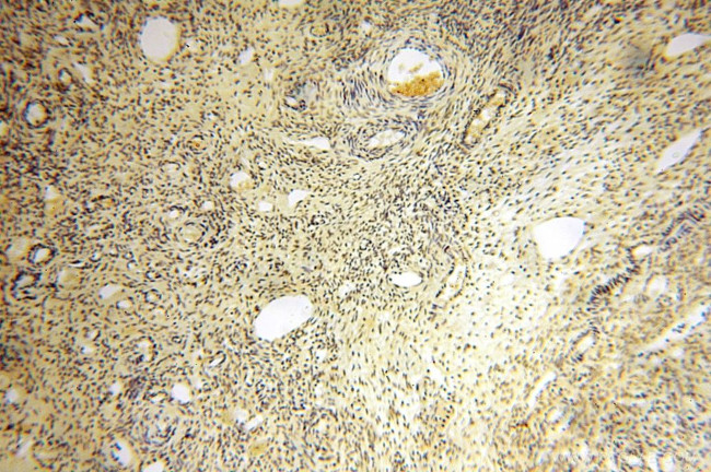 ERCC1 Antibody in Immunohistochemistry (Paraffin) (IHC (P))