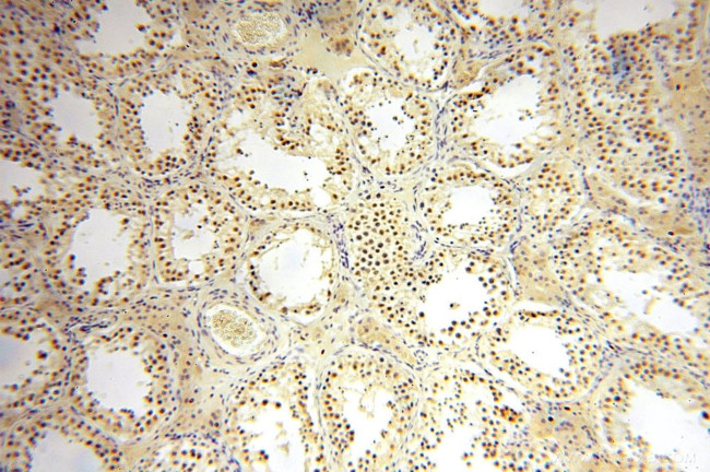 ERCC1 Antibody in Immunohistochemistry (Paraffin) (IHC (P))