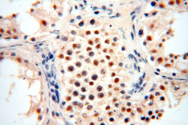 ERCC1 Antibody in Immunohistochemistry (Paraffin) (IHC (P))