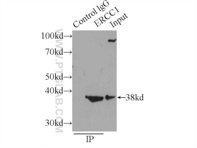 ERCC1 Antibody in Immunoprecipitation (IP)