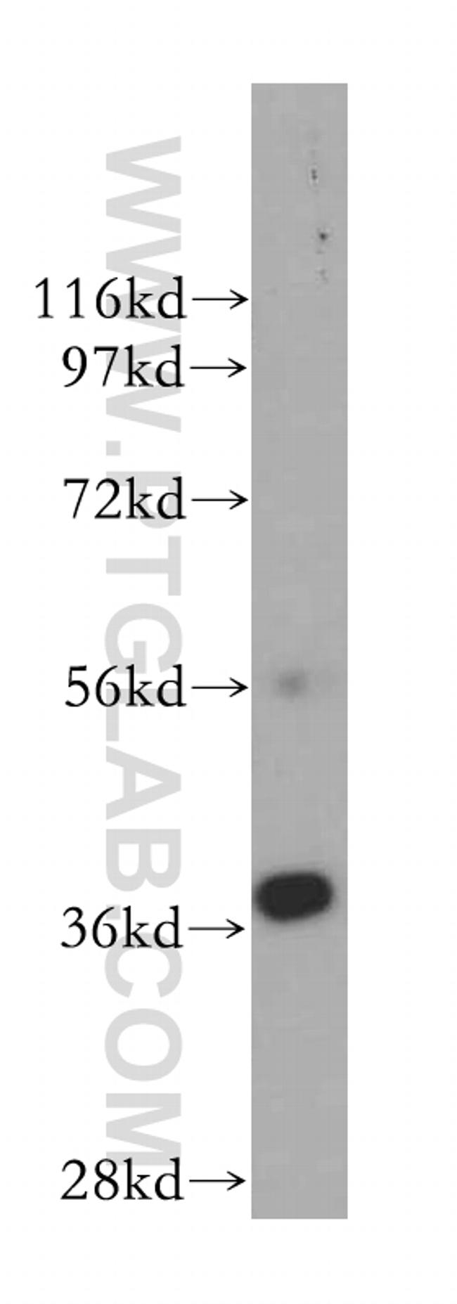 ERCC1 Antibody in Western Blot (WB)