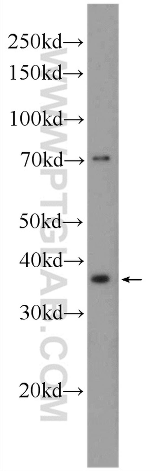 ERCC1 Antibody in Western Blot (WB)