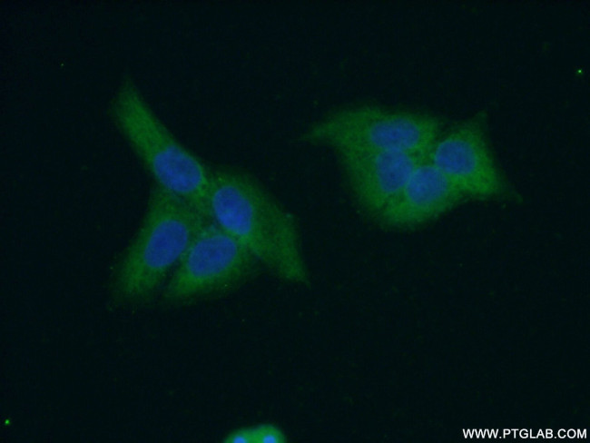 CES3 Antibody in Immunocytochemistry (ICC/IF)