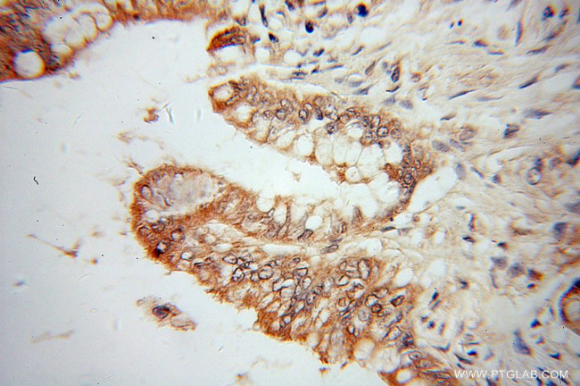 CES3 Antibody in Immunohistochemistry (Paraffin) (IHC (P))