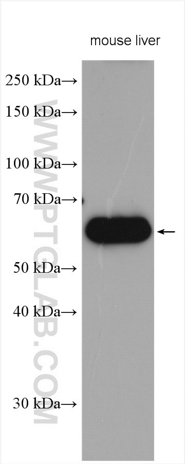 CES3 Antibody in Western Blot (WB)