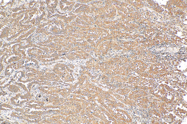 NRARP Antibody in Immunohistochemistry (Paraffin) (IHC (P))