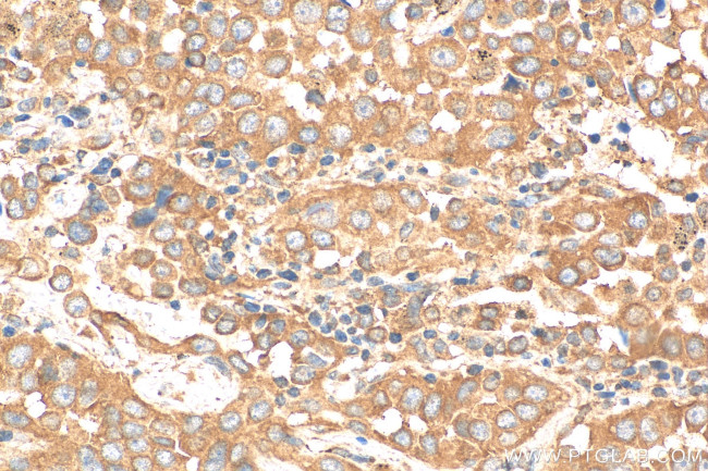 NRARP Antibody in Immunohistochemistry (Paraffin) (IHC (P))