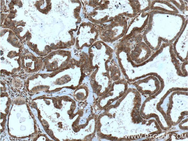 IKIP Antibody in Immunohistochemistry (Paraffin) (IHC (P))