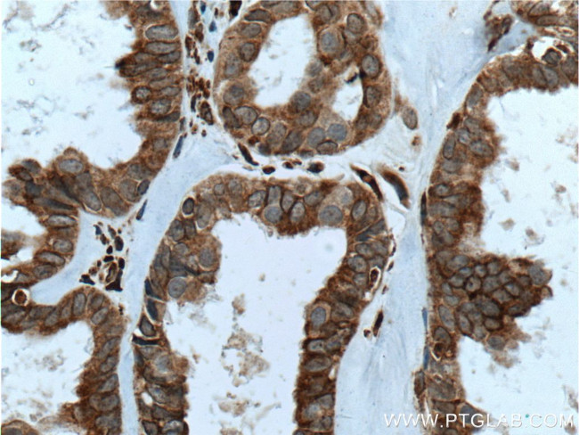 IKIP Antibody in Immunohistochemistry (Paraffin) (IHC (P))