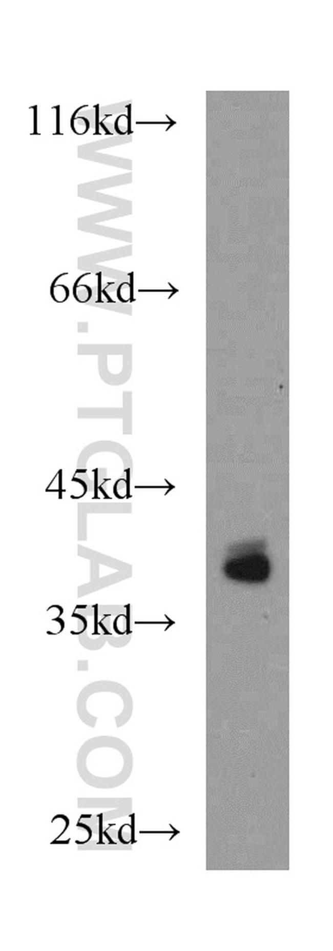 IKIP Antibody in Western Blot (WB)