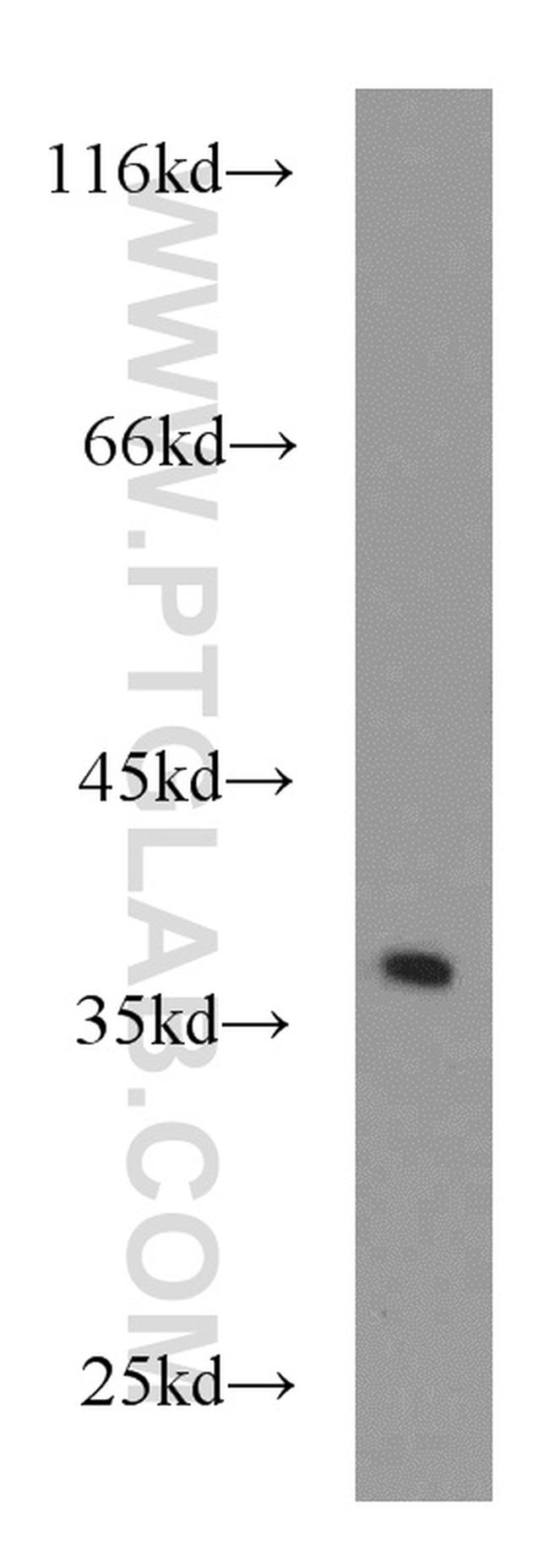 IKIP Antibody in Western Blot (WB)