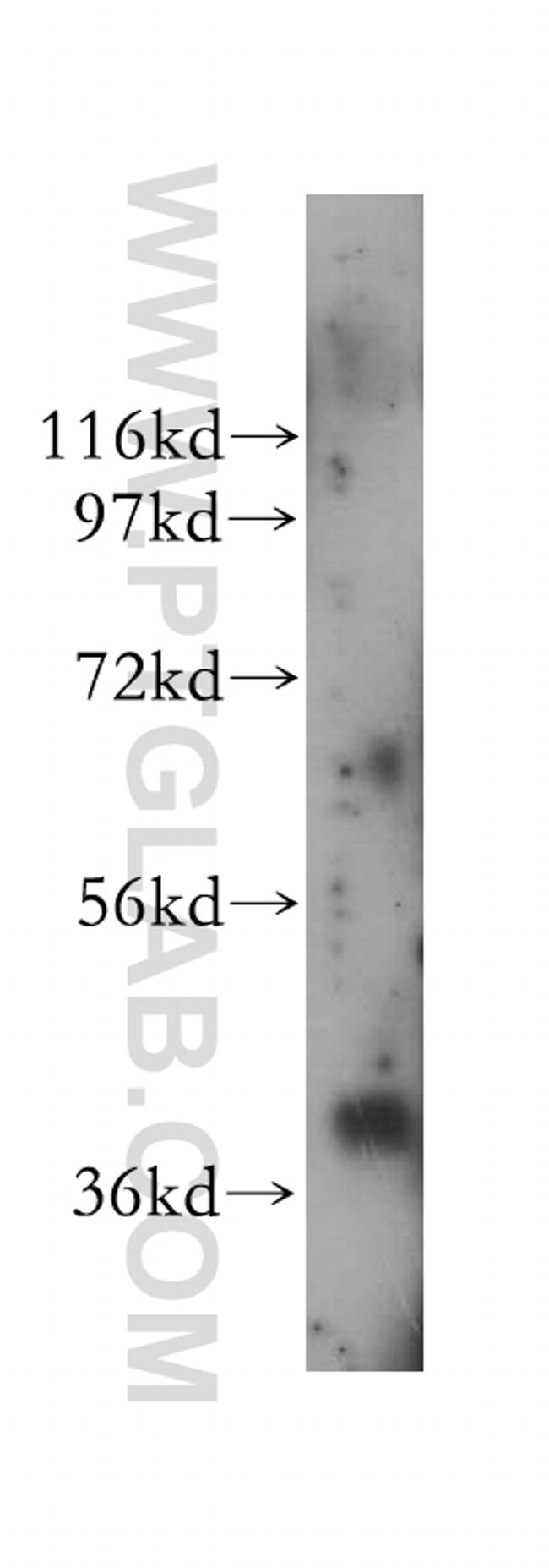 IKIP Antibody in Western Blot (WB)