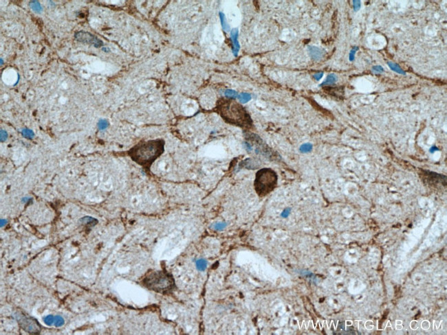 FBXO2 Antibody in Immunohistochemistry (Paraffin) (IHC (P))