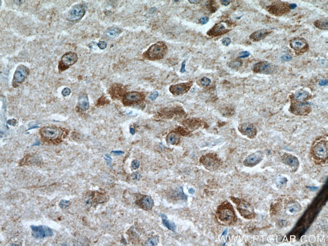 FBXO2 Antibody in Immunohistochemistry (Paraffin) (IHC (P))