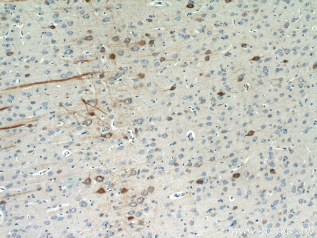 FBXO2 Antibody in Immunohistochemistry (Paraffin) (IHC (P))