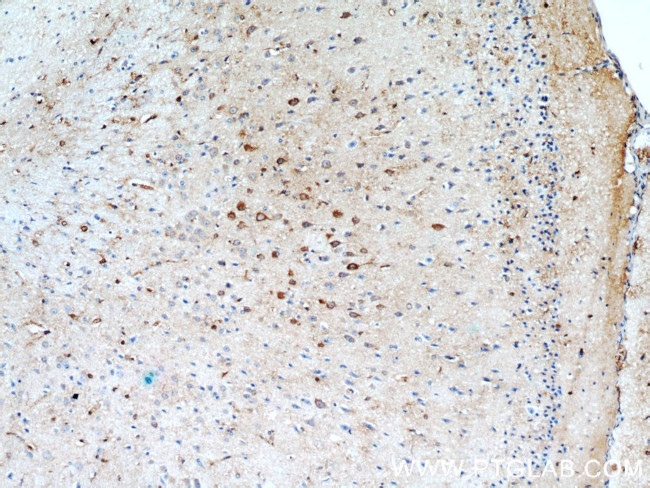 FBXO2 Antibody in Immunohistochemistry (Paraffin) (IHC (P))