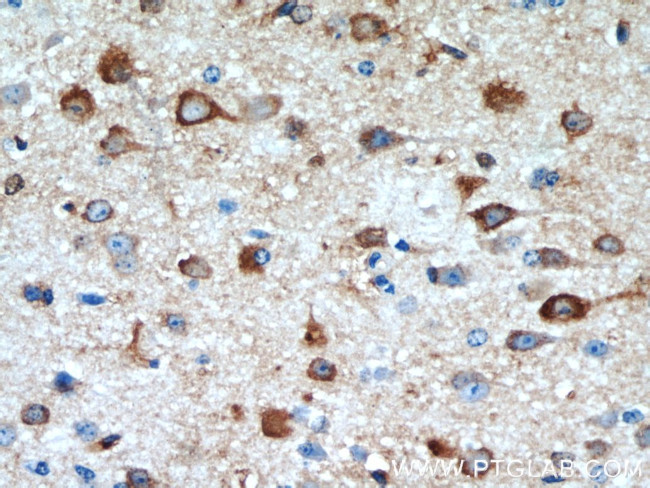 FBXO2 Antibody in Immunohistochemistry (Paraffin) (IHC (P))