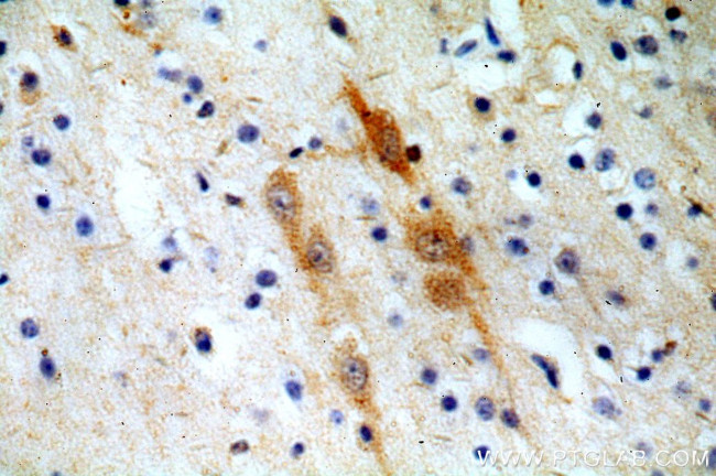 FBXO2 Antibody in Immunohistochemistry (Paraffin) (IHC (P))