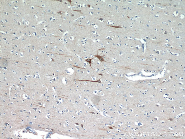 FBXO2 Antibody in Immunohistochemistry (Paraffin) (IHC (P))