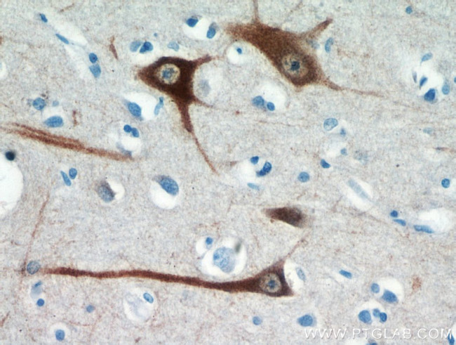 FBXO2 Antibody in Immunohistochemistry (Paraffin) (IHC (P))