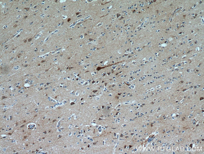 FBXO2 Antibody in Immunohistochemistry (Paraffin) (IHC (P))