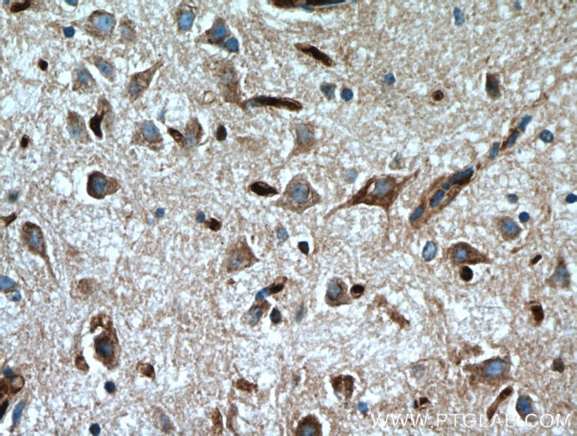 FBXO2 Antibody in Immunohistochemistry (Paraffin) (IHC (P))