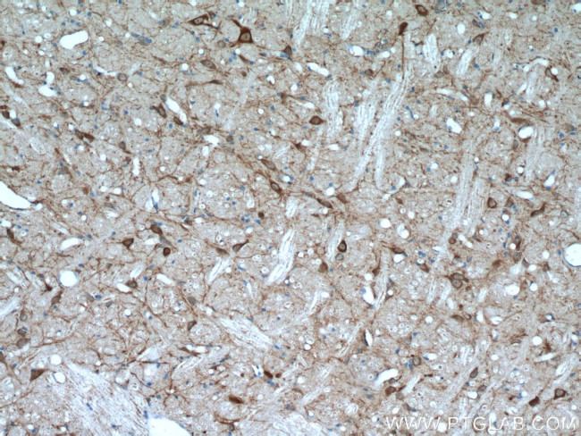 FBXO2 Antibody in Immunohistochemistry (Paraffin) (IHC (P))