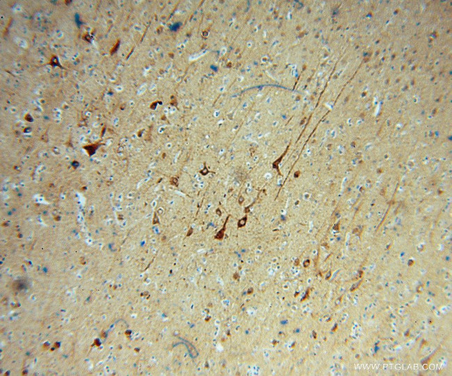 FBXO2 Antibody in Immunohistochemistry (Paraffin) (IHC (P))