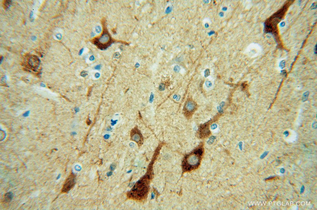 FBXO2 Antibody in Immunohistochemistry (Paraffin) (IHC (P))