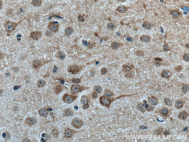 FBXO2 Antibody in Immunohistochemistry (Paraffin) (IHC (P))