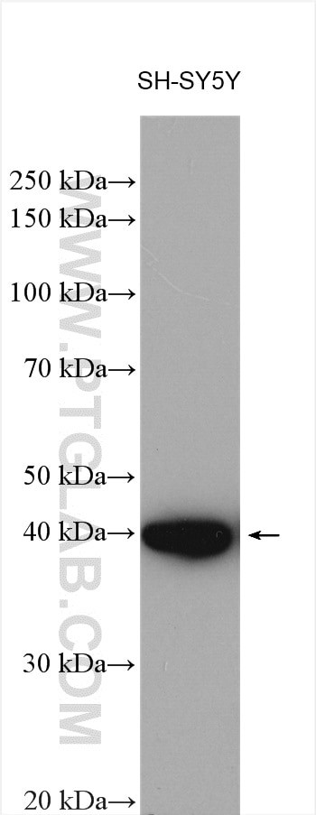 FBXO2 Antibody in Western Blot (WB)