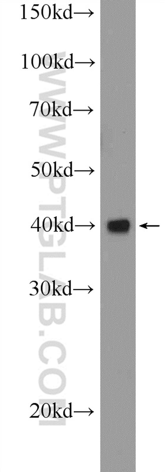 FBXO2 Antibody in Western Blot (WB)