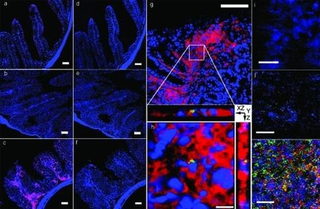 Ly-6G/Ly-6C Antibody in Immunohistochemistry (IHC)