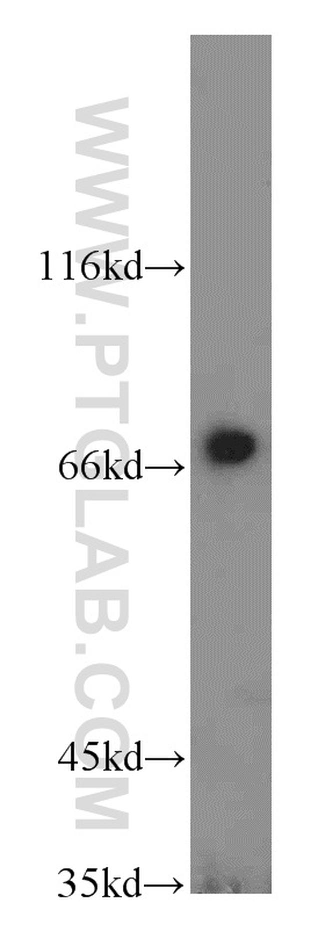 RAB11FIP5 Antibody in Western Blot (WB)