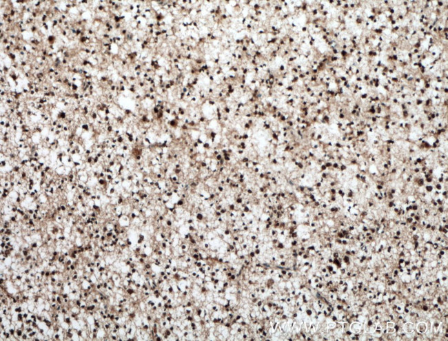 BRN2 Antibody in Immunohistochemistry (Paraffin) (IHC (P))