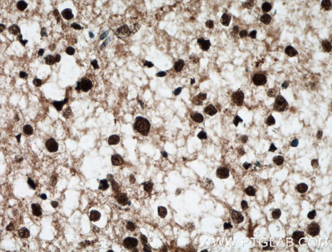 BRN2 Antibody in Immunohistochemistry (Paraffin) (IHC (P))