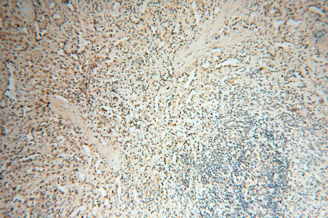 BRN2 Antibody in Immunohistochemistry (Paraffin) (IHC (P))