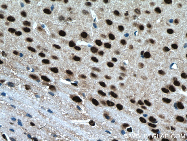 BRN2 Antibody in Immunohistochemistry (Paraffin) (IHC (P))