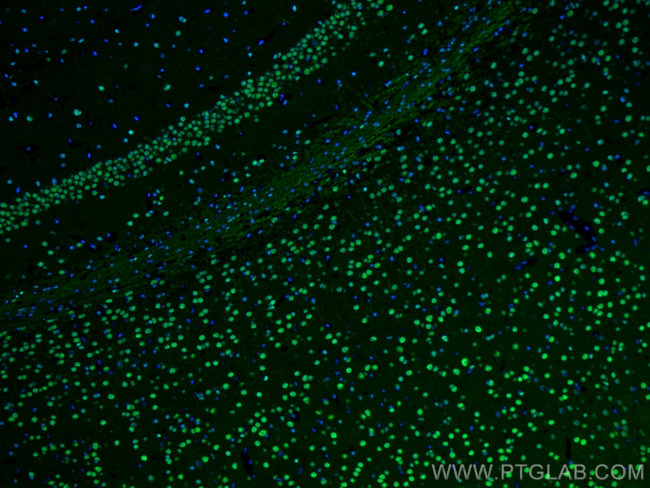 BRN2 Antibody in Immunohistochemistry (PFA fixed) (IHC (PFA))