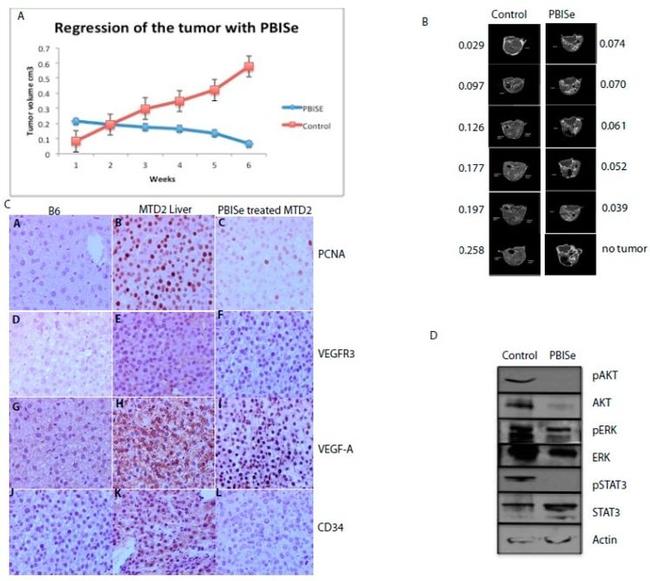 VEGF Receptor 3 Antibody