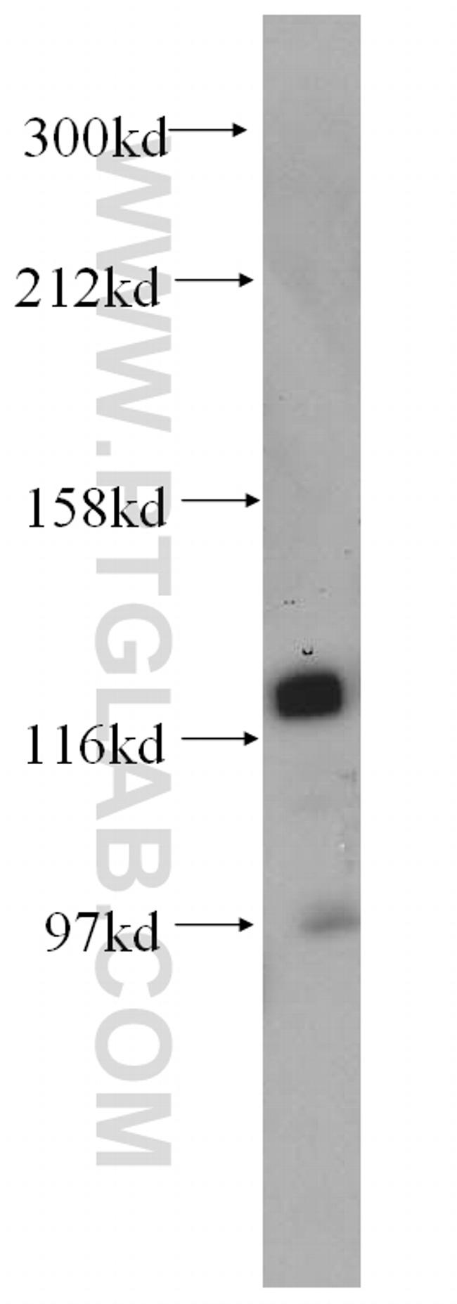 HNRNPU Antibody in Western Blot (WB)