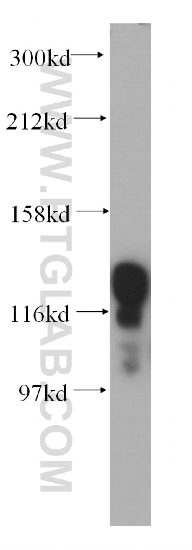 HNRNPU Antibody in Western Blot (WB)